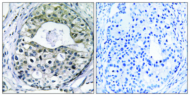 Anti-RPS13 antibody produced in rabbit