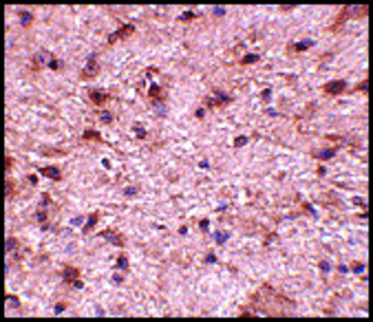 Anti-NIPSNAP3B antibody produced in rabbit