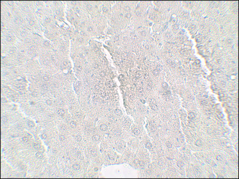 Anti-BETATROPHIN antibody produced in rabbit
