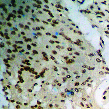 Anti-phospho-BRCA1 (pSer¹?²³) antibody produced in