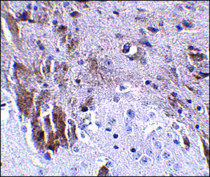 Anti-LRFN1 antibody produced in rabbit