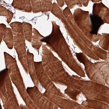 Anti-TPM1 antibody produced in rabbit