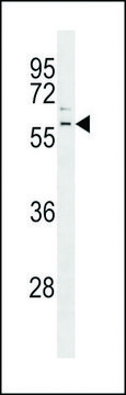 ANTI-PARKIN(C-TERMINAL) antibody produced in rabbit