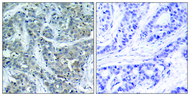 Anti-Stathmin 1 antibody produced in