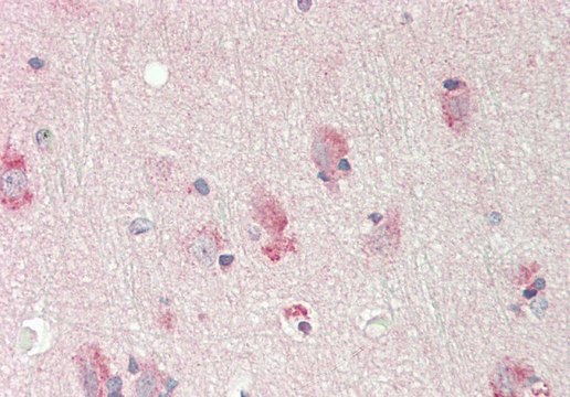 Anti-ST6GALNAC1 antibody produced in rabbit