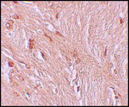 Anti-ZBTB3 antibody produced in rabbit