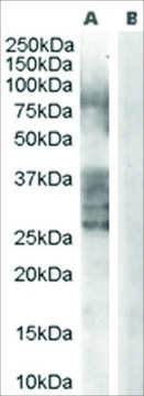 Anti-ADAM33 antibody produced in goat