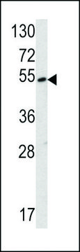 ANTI-SUV4-20H2 (CENTER) antibody produced in