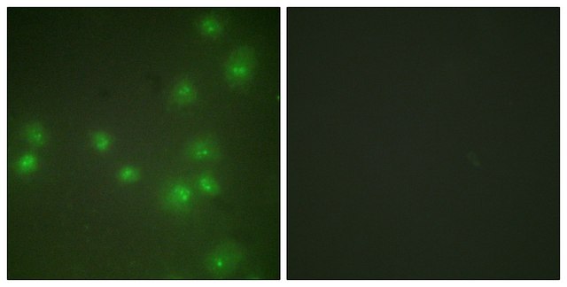 Anti-ZNF265 antibody produced in rabbit