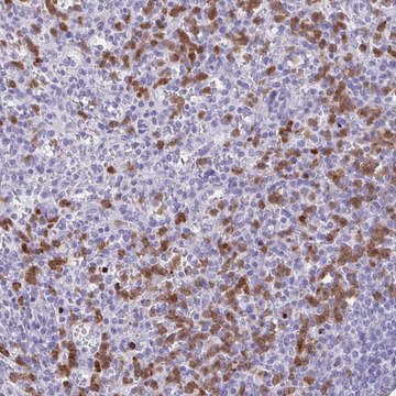 Anti-CEP120 antibody produced in rabbit