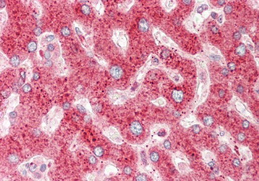 Anti-CRIP1, (N-terminal) antibody produced in