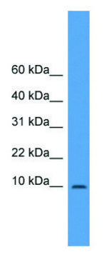 Anti-IAPP (N-terminal) antibody produced in