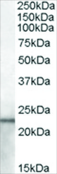Anti-Lipocalin 2/NGAL (AB2) antibody produced