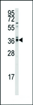 ANTI-PP2A ALPHA(N-TERMINAL) antibody produced in