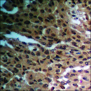 Anti-phospho-RAD52 (pTyr¹??) antibody produced in