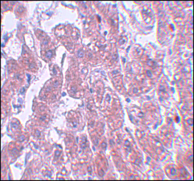Anti-FAM59A antibody produced in rabbit