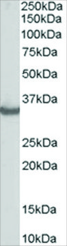 Anti-STUB1/CHIP antibody produced in goat