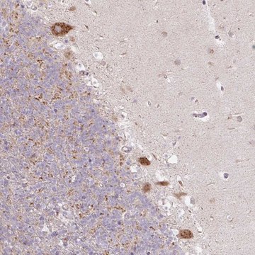 Anti-MLX antibody produced in rabbit
