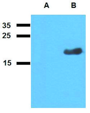 Anti-Acr2 (M. tuberculosis) antibody produced