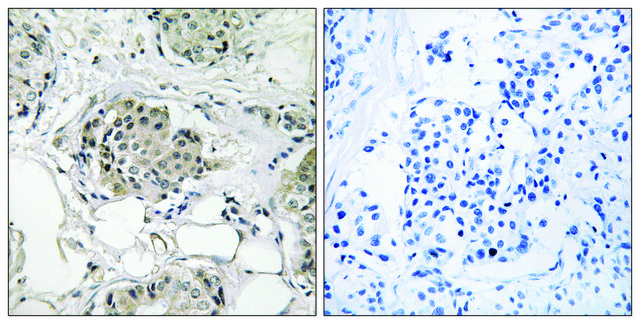Anti-USP13 antibody produced in rabbit