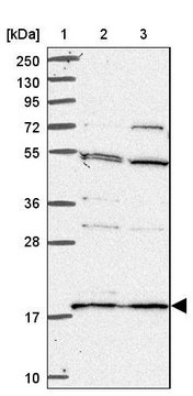 Anti-RPS18 antibody produced in rabbit