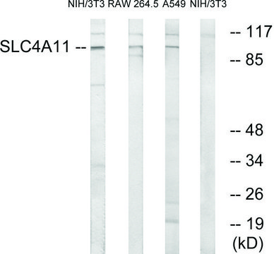 Anti-SLC4A11 antibody produced in rabbit