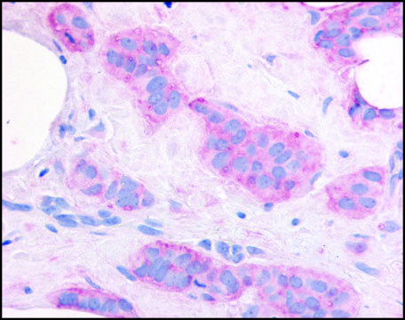 Anti-KDR (AB2) antibody produced in