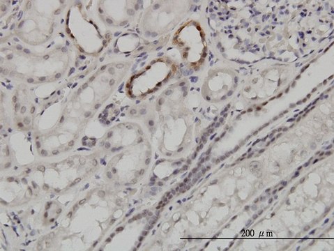 Monoclonal Anti-ARID1B antibody produced in