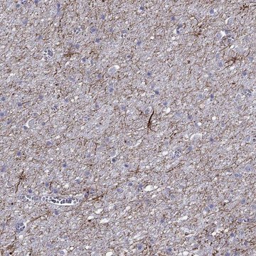 Anti-TMEM155 antibody produced in rabbit