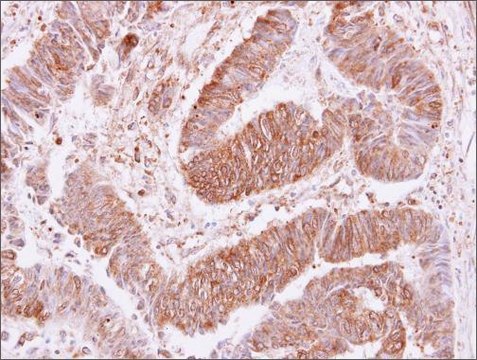 Anti-VPS35 (C-terminal) antibody produced in