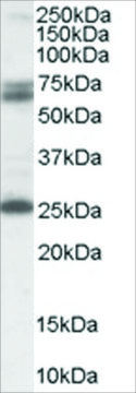Anti-GAD2/GAD65 antibody produced in goat