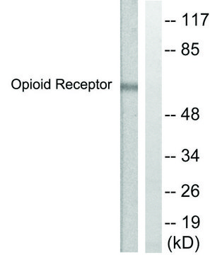 Anti-CCR5, C-Terminal antibody produced in
