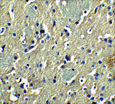 Anti-PION antibody produced in rabbit