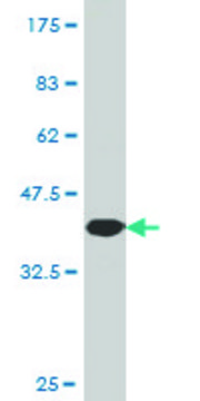Monoclonal Anti-NEK5, (C-terminal) antibody produced