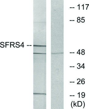 Anti-SFRS4 antibody produced in rabbit