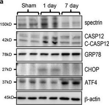 Monoclonal Anti-ATF4 antibody produced in