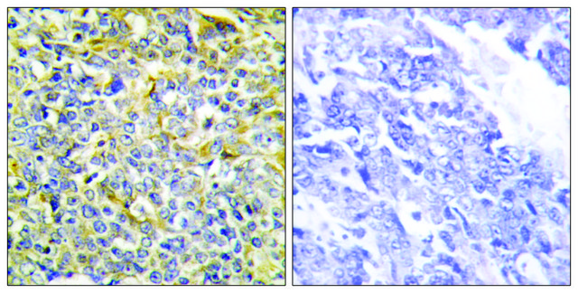 Anti-TFIP8 antibody produced in rabbit