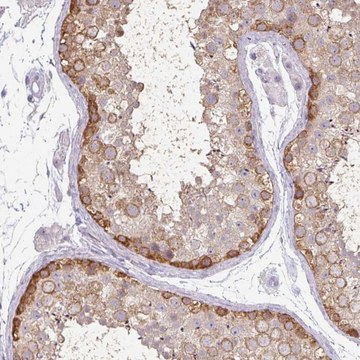 Anti-MAGEC3 antibody produced in rabbit