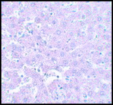 Anti-CALHM1 antibody produced in rabbit