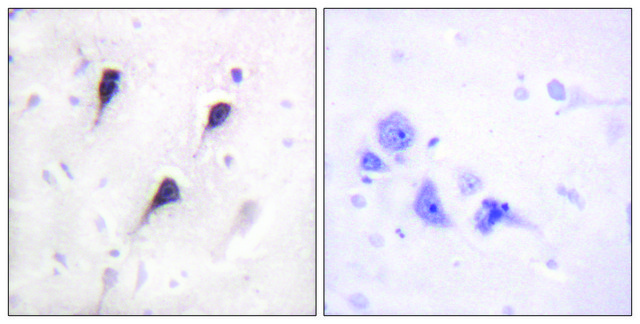Anti-WAVE1 antibody produced in rabbit