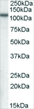 Anti-MP100/NPEPPS antibody produced in goat
