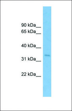 Anti-SSR1 antibody produced in rabbit