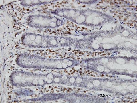 ANTI-MKNK1 antibody produced in mouse