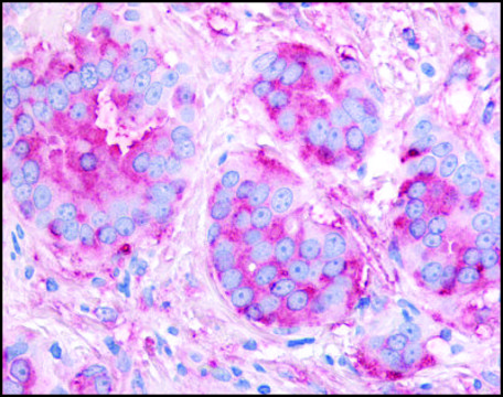 Anti-KDR (AB1) antibody produced in