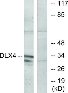 Anti-DLX4 antibody produced in rabbit