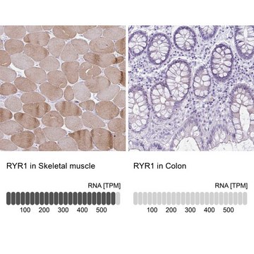 Anti-RYR1 antibody produced in rabbit