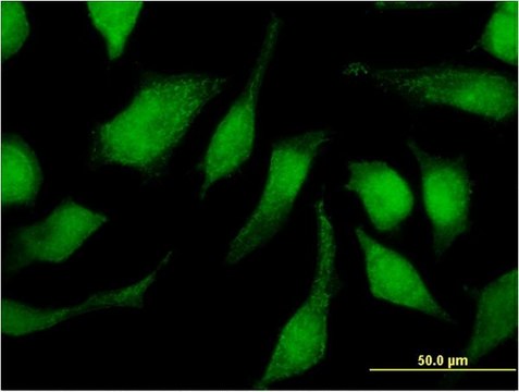Monoclonal Anti-TRIM47, (C-terminal) antibody produced