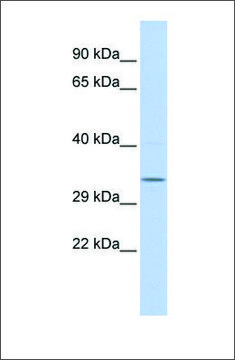 Anti-NMRAL1 antibody produced in rabbit