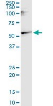 Monoclonal Anti-CNR1, (N-terminal) antibody produced