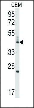 Anti-BCL2L13 (center) antibody produced in